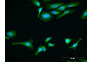 Immunofluorescence of purified MaxPab antibody to PABPC1 on HeLa cell. (PABP Antikörper  (AA 1-636))