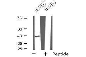 Western blot analysis of extracts from HUVEC cells using GPRC5B antibody. (GPRC5B Antikörper  (Internal Region))