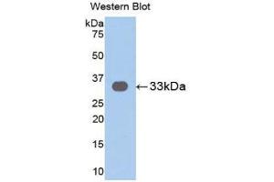 Western Blotting (WB) image for anti-Interleukin 31 Receptor A (IL31RA) (AA 205-456) antibody (ABIN1859419) (IL31RA Antikörper  (AA 205-456))