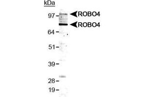 Western blot analysis of ROBO4 in HUVEC cell lysate with ROBO4 polyclonal antibody .