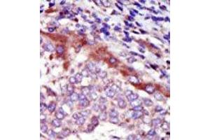Image no. 2 for anti-Hormonally Up-Regulated Neu-Associated Kinase (HUNK) (C-Term) antibody (ABIN360358) (HUNK Antikörper  (C-Term))
