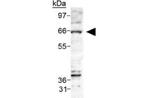 Western blot analysis of CERK on Ceramide Kinase in A-549 cell lysate using CERK polyclonal antibody . (CERK Antikörper  (AA 50-150))