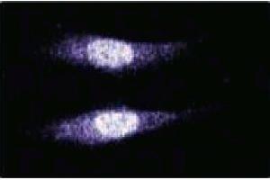 Immunofluorescence staining of human endothelial cells. (MAD2L2 Antikörper  (AA 81-180))