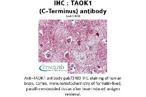 Image no. 1 for anti-TAO Kinase 1 (TAOK1) (C-Term) antibody (ABIN1739898) (TAO Kinase 1 (TAOK1) (C-Term) Antikörper)