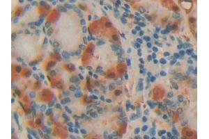 DAB staining on IHC-P; Samples: Human Stomach Tissue (ADA Antikörper  (AA 11-280))