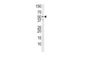 Western blot analysis of anti-HH3R Pab (Rabbit ID 1071) in Jurkat cell line lysate (35 μg/lane). (HRH3 Antikörper  (C-Term))