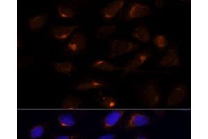 Immunofluorescence analysis of U-2 OS cells using SCD Polyclonal Antibody at dilution of 1:100 (40x lens). (SCD Antikörper)