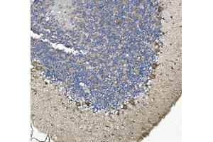 IHC analysis of non-muscle Myosin IIB/MYH10 using anti-non-muscle Myosin IIB/MYH10 antibody (ABIN7603186). (MYH10 Antikörper  (N-Term))