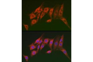 Immunofluorescence analysis of NIH/3T3 cells using MTMR14 Rabbit pAb (ABIN6129695, ABIN6144154, ABIN6144155 and ABIN6223372) at dilution of 1:100 (40x lens). (MTMR14 Antikörper  (AA 1-280))
