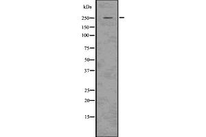 Western blot analysis Aggrecan using 293 whole cell lysates. (Aggrecan Antikörper)