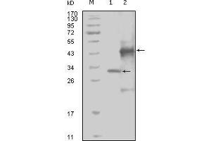 Western blot analysis using EphA4 mouse mAb against truncated Trx-EphA4 recombinant protein (1) and truncated GST-EphA4(aa777-986) recombinant protein (2).