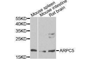 Western blot analysis of extracts of various cell lines, using ARPC5 antibody. (ARPC5 Antikörper)