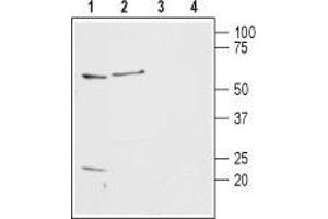 Western blot analysis of rat basophilic leukemia cells (RBL) (lanes 1 and 3) and rat brain lysates (lanes 2 and 4): - 1,2. (HRH2 Antikörper  (2nd Extracellular Loop))