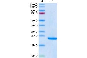 Human Midkine on Tris-Bis PAGE under reduced condition. (Midkine Protein (AA 21-143) (His-Avi Tag))