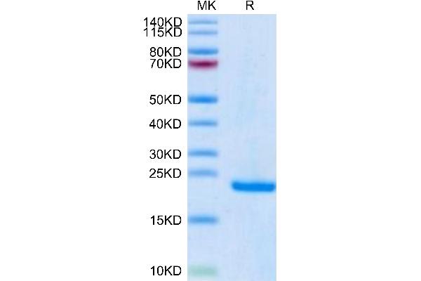 Midkine Protein (AA 21-143) (His-Avi Tag)