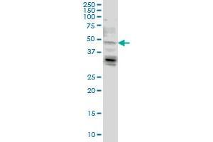 LASS4 monoclonal antibody (M03), clone 7D5 Western Blot analysis of LASS4 expression in HeLa . (LASS4 Antikörper  (AA 57-139))