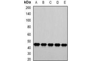 Western blot analysis of PSMC4 expression in HepG2 (A), A549 (B), Hela (C), Jurkat (D), mouse liver (E) whole cell lysates.