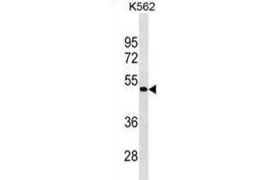 Western Blotting (WB) image for anti-G Protein-Coupled Receptor 39 (GPR39) antibody (ABIN3000707) (GPR39 Antikörper)