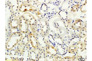 Formalin-fixed and paraffin embedded rat kidney labeled with Anti- NCX2/SLC8A2 Polyclonal Antibody, Unconjugated (ABIN676478) at 1:200 followed by conjugation to the secondary antibody and DAB staining (SLC8A2 Antikörper  (AA 601-700))