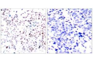 Image no. 3 for anti-Myc Proto-Oncogene protein (MYC) (pThr358) antibody (ABIN196675) (c-MYC Antikörper  (pThr358))