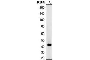 Western blot analysis of RIMKLA expression in Jurkat (A) whole cell lysates.