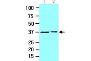 Cell lysates of HeLa (lane 1) and 293T (lane 2) (20 ug) were resolved by SDS-PAGE and probed with EPM2A monoclonal antibody, clone k2A3  (1:1000). (EPM2A Antikörper  (AA 243-331))