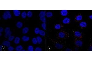 Immunocytochemistry/Immunofluorescence analysis using Mouse Anti-VPS35 Monoclonal Antibody, Clone 7E4 (ABIN6932908). (VPS35 Antikörper)