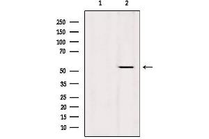 Western blot analysis of extracts from Hela, using KRT36 Antibody. (Keratin 36 Antikörper  (Internal Region))