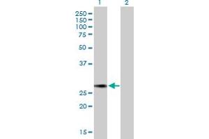 Western Blot analysis of NUSAP1 expression in transfected 293T cell line by NUSAP1 MaxPab polyclonal antibody. (NUSAP1 Antikörper  (AA 1-226))