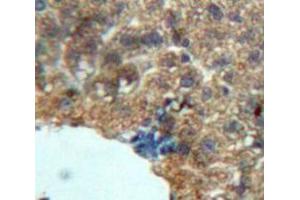 Used in DAB staining on fromalin fixed paraffin-embedded Liver tissue (Growth Hormone 1 Antikörper  (AA 28-216))
