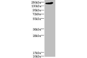 Western blot All lanes: LRP4 antibody at 1. (LRP4 Antikörper  (AA 1500-1725))