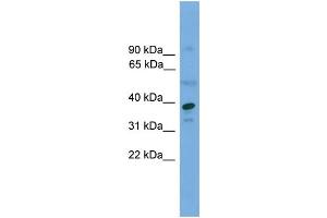 WB Suggested Anti-APEX1  Antibody Titration: 0. (APEX1 Antikörper  (Middle Region))