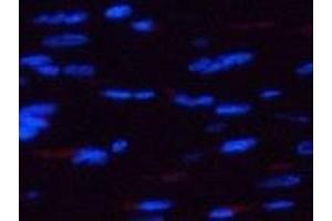 Immunofluorescence analysis of Rat heart tissue using Phospho-AMPK alpha1/2 (Thr183/172) Polyclonal Antibody at dilution of 1:200 (PRKAA1/PRKAA2 Antikörper  (pThr172, pThr183))