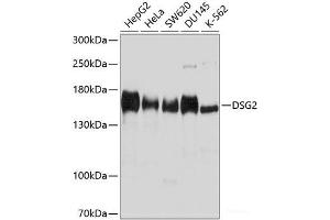 Western blot analysis of extracts of various cell lines using DSG2 Polyclonal Antibody at dilution of 1:1000. (Desmoglein 2 Antikörper)
