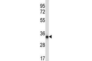 AMPK beta 2 antibody western blot analysis in A375 lysate. (PRKAB2 Antikörper  (AA 3-33))