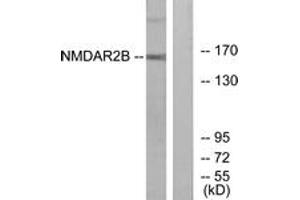 Western blot analysis of extracts from Jurkat cells, using NMDAR2B (Ab-1474) Antibody. (GRIN2B Antikörper  (AA 1435-1484))