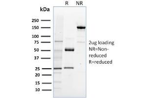 SDS-PAGE Analysis Purified NRF1 Mouse Monoclonal Antibody (NRF1/2608).