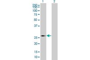 Western Blot analysis of PMM2 expression in transfected 293T cell line by PMM2 MaxPab polyclonal antibody. (PMM2 Antikörper  (AA 1-246))