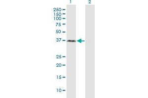 Western Blot analysis of RNF2 expression in transfected 293T cell line by RNF2 monoclonal antibody (M03), clone 3G6.