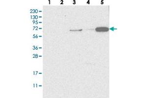 Western blot analysis of Lane 1: RT-4, Lane 2: U-251 MG, Lane 3: Human Plasma, Lane 4: Liver, Lane 5: Tonsil with SH3TC2 polyclonal antibody . (SH3TC2 Antikörper)