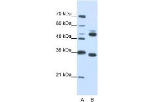 WB Suggested Anti-WDR6  Antibody Titration: 0. (WDR6 Antikörper  (C-Term))