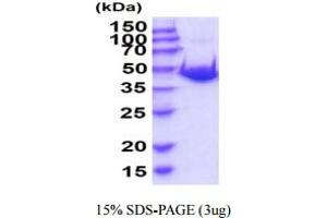 SDS-PAGE (SDS) image for Adenosylhomocysteinase (AHCY) (AA 1-432) protein (His tag) (ABIN5854973) (AHCY Protein (AA 1-432) (His tag))