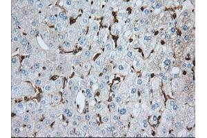 Immunohistochemistry (IHC) image for anti-Aldehyde Dehydrogenase 3 Family, Member A1 (ALDH3A1) antibody (ABIN1496591) (ALDH3A1 Antikörper)