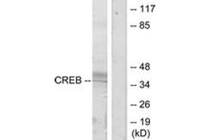 Western blot analysis of extracts from HeLa cells, treated with UV, using CREB (Ab-133) Antibody. (CREB1 Antikörper  (AA 100-149))