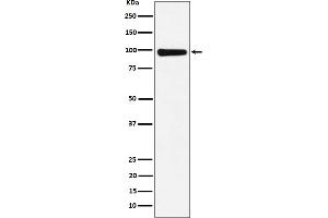 Western blot analysis of CHM expression in 293T cell lysate.