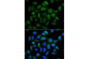 Immunofluorescence analysis of HeLa cells using AFP antibody. (alpha Fetoprotein Antikörper  (AA 360-609))