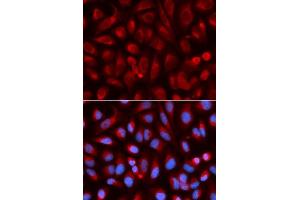 Immunofluorescence analysis of U2OS cell using ADA antibody. (ADA Antikörper  (AA 1-363))