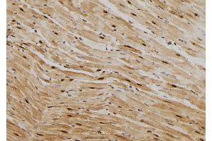 ABIN6269012 at 1/100 staining Rat heart tissue by IHC-P. (HSP70 1A Antikörper  (C-Term))