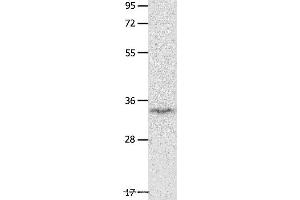Western blot analysis of Mouse brain tissue, using IGFBP7 Polyclonal Antibody at dilution of 1:400 (IGFBP7 Antikörper)