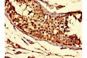 Immunohistochemistry of paraffin-embedded human testis tissue using ABIN7170279 at dilution of 1:100 (Solute Carrier Family 52 (Riboflavin Transporter), Member 3 (SLC52A3) (AA 159-220) Antikörper)